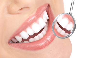 Estetica odontoiatrica, come funziona lo sbiancamento dentale