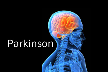 Parkinson come riconoscerlo?